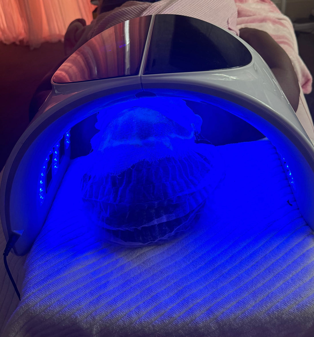 "Glowing Beyond Boundaries: The Transformative Power of Facials for Hyperpigmentation, Acne, and Skin Conditions"